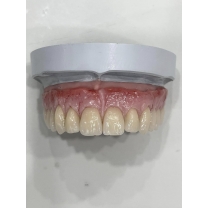 Răng sứ thẩm mỹ Cercon HCT