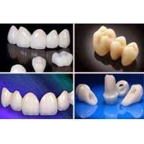 Răng sứ Ziconia và Cercon HT