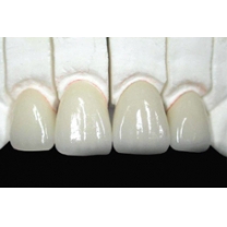 RĂNG SỨ CERCON BASE