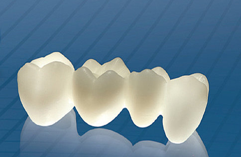 RĂNG SỨ CERCON HT