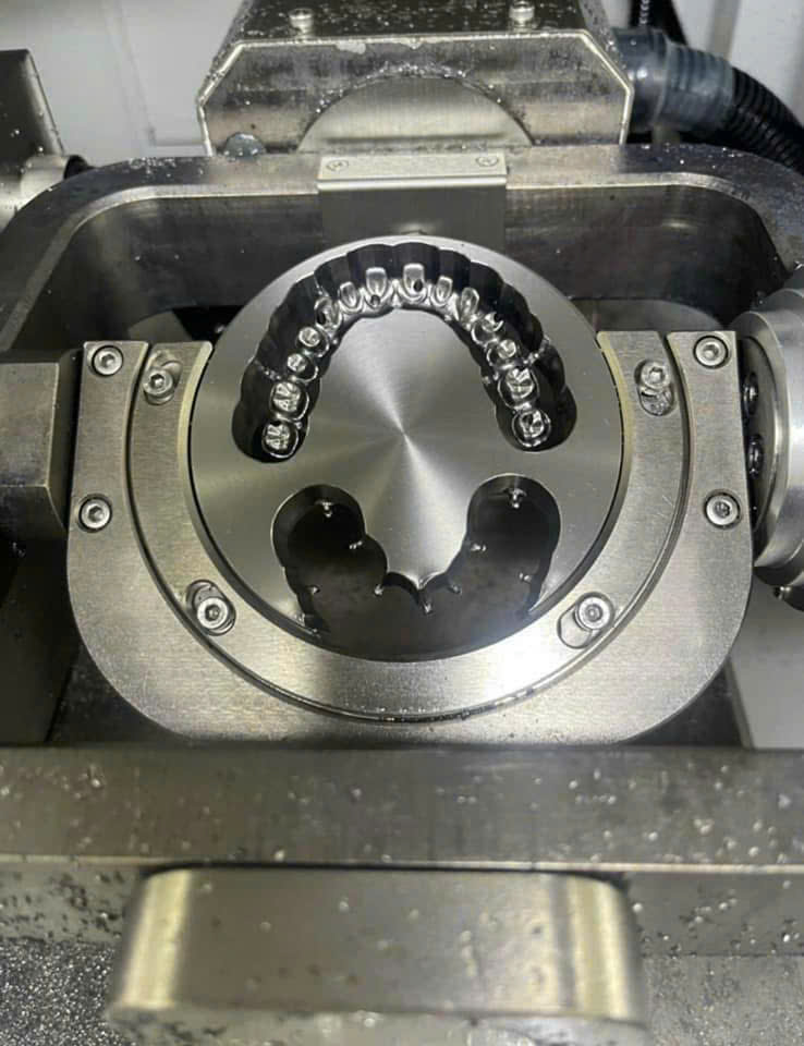 Toàn hàm CAD/CAM trên implant